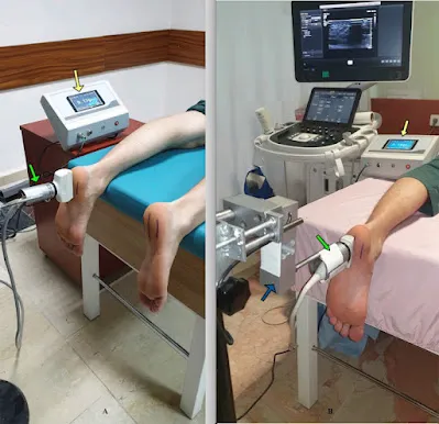 臨床治療照片，分 A、B 兩格：足踝接受儀器治療與超音波檢查的設置